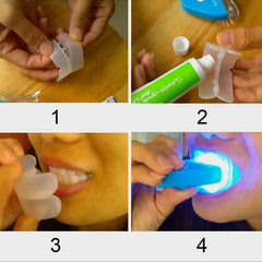 Zahnaufhellungsgel für die Mundschleimhaut, LED-Lichttherapie zur Zahnaufhellung